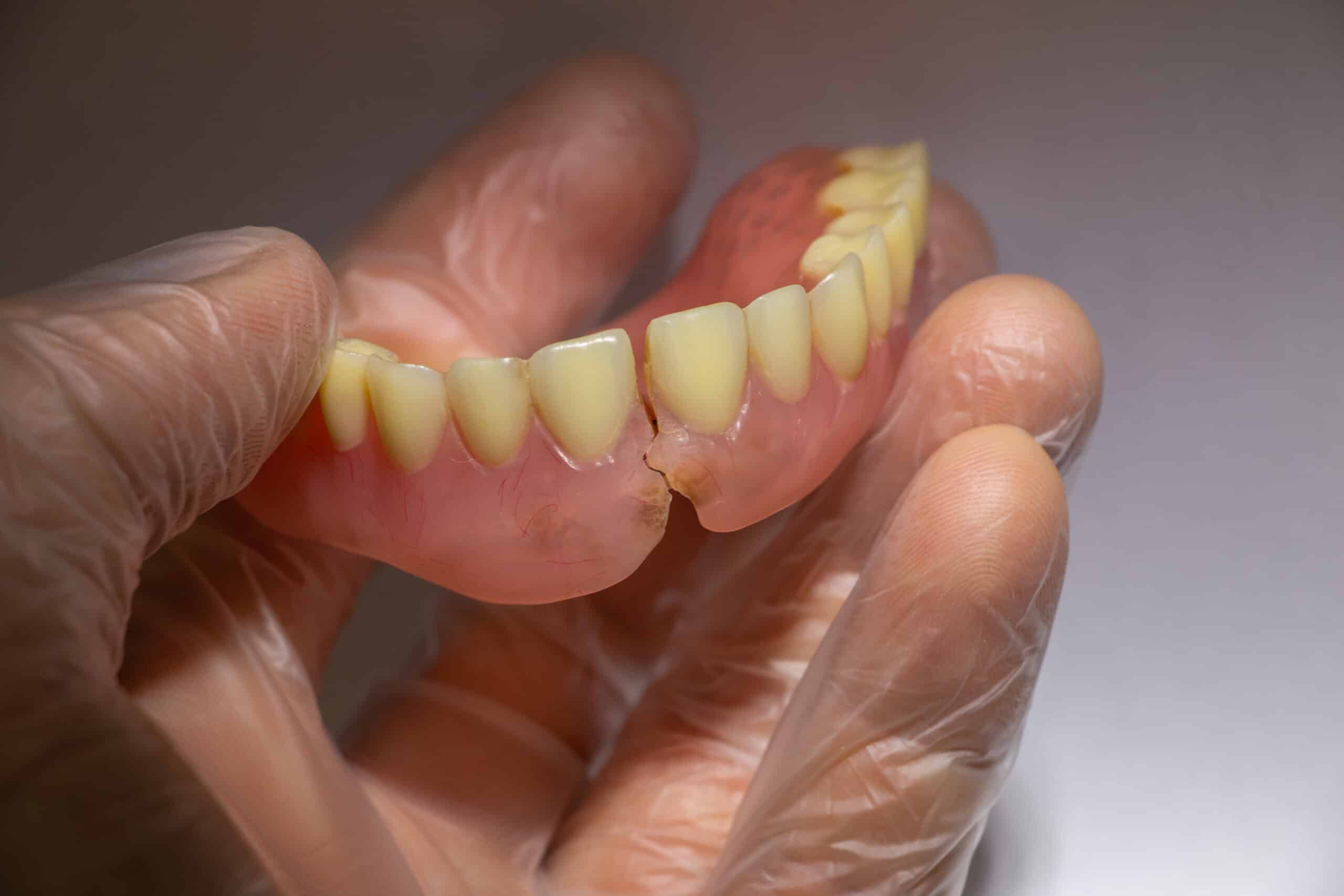 pair of broken dentures in a dentists hand