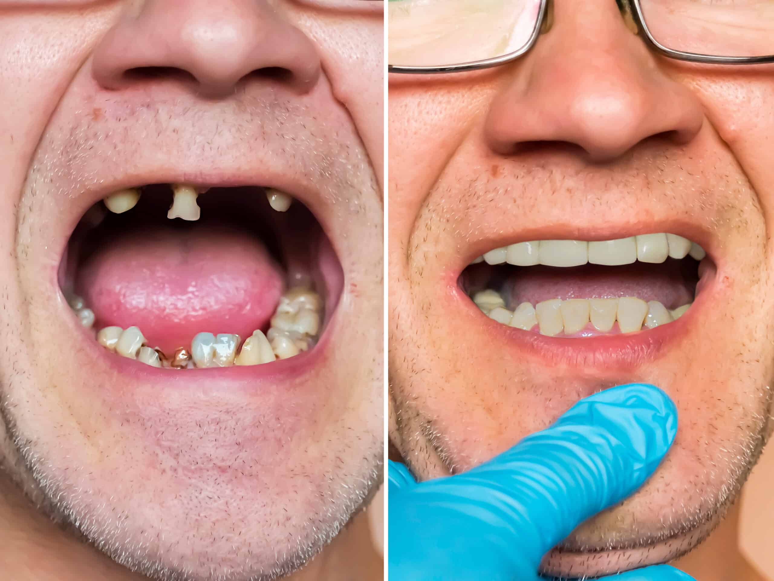 dentist examines a patient before treatment, and after restoration