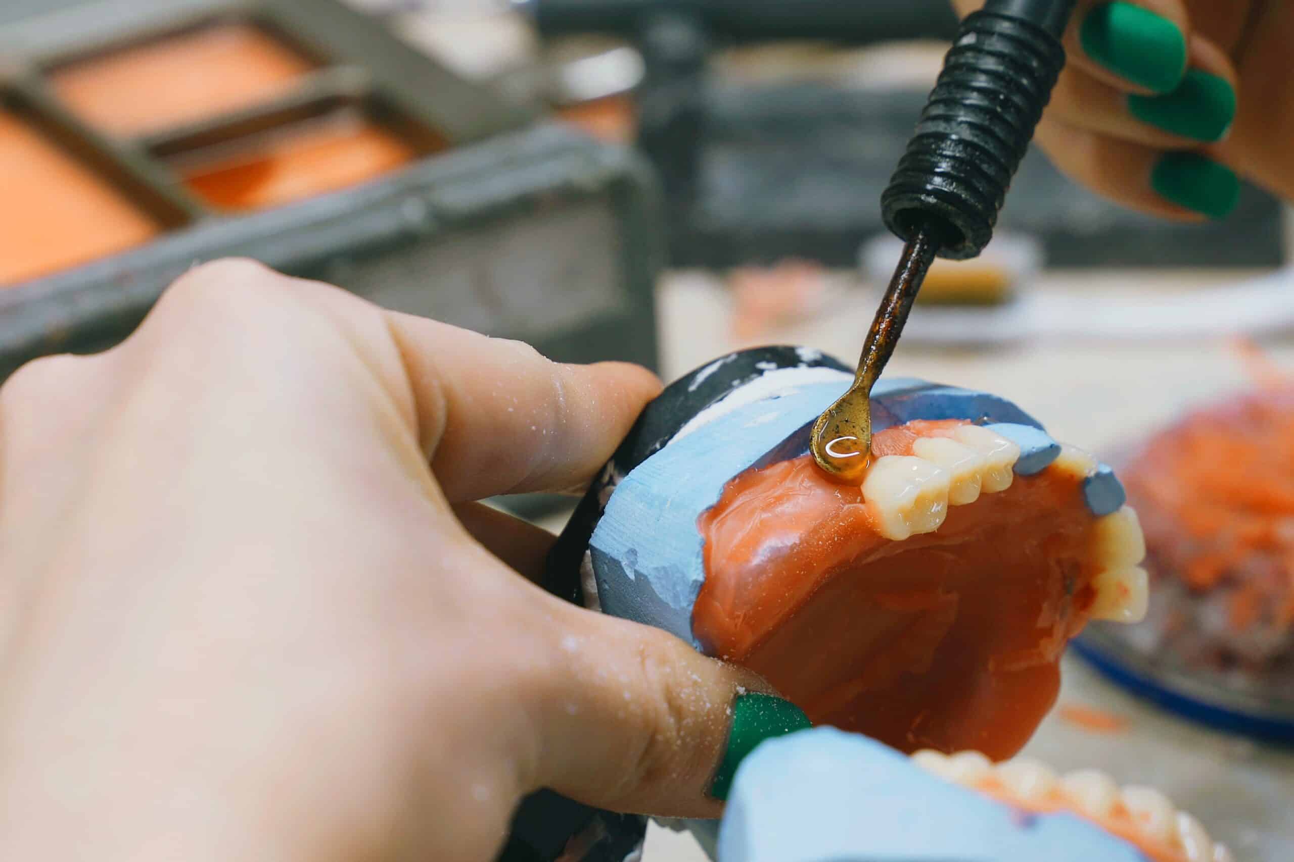 A dental technician meticulously works on repairing dentures using specialized tools and techniques to ensure precision and quality