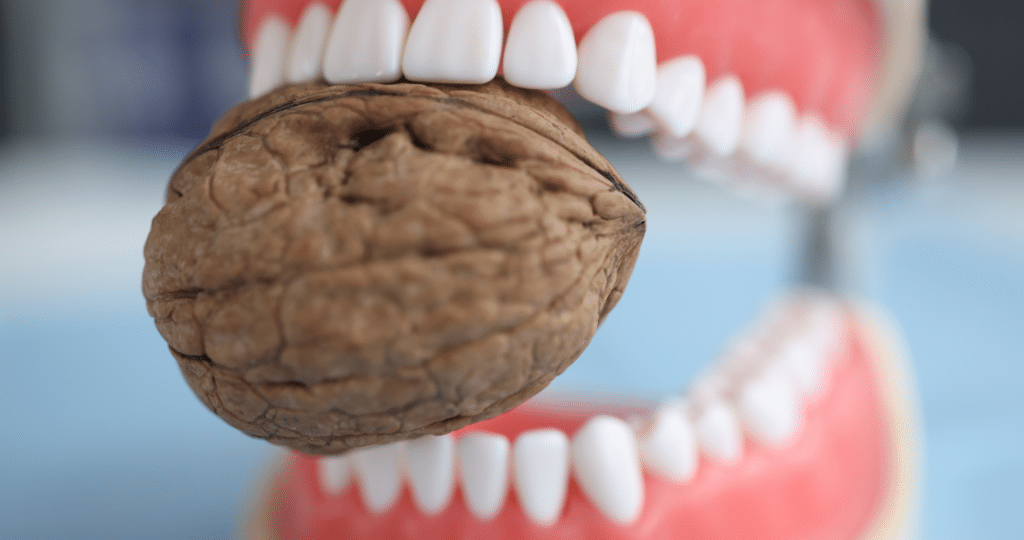 Nuts and healthy foods that help strengthen teeth and support healthy gums naturally